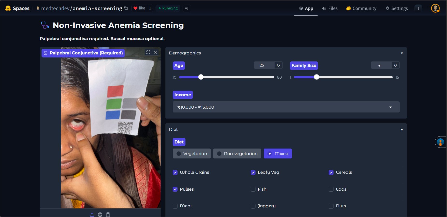 Conjunctival image capture with colour calibration card